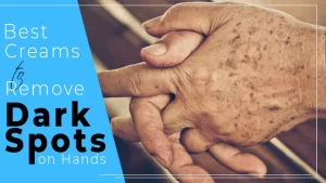 Best Cream to Remove Dark Spots on Hands (Top 7 in 2023)
