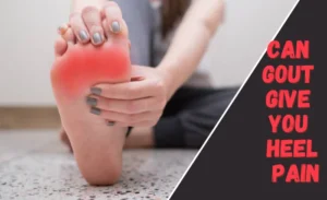 Can Gout Give You Heel Pain