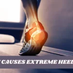 What Causes Extreme Heel Pain