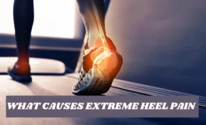 What Causes Extreme Heel Pain A Comprehensive Guide