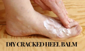 The Ultimate Guide to Creating DIY Cracked Heel Balm
