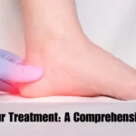 Heel Spur Treatment: A Comprehensive Guide